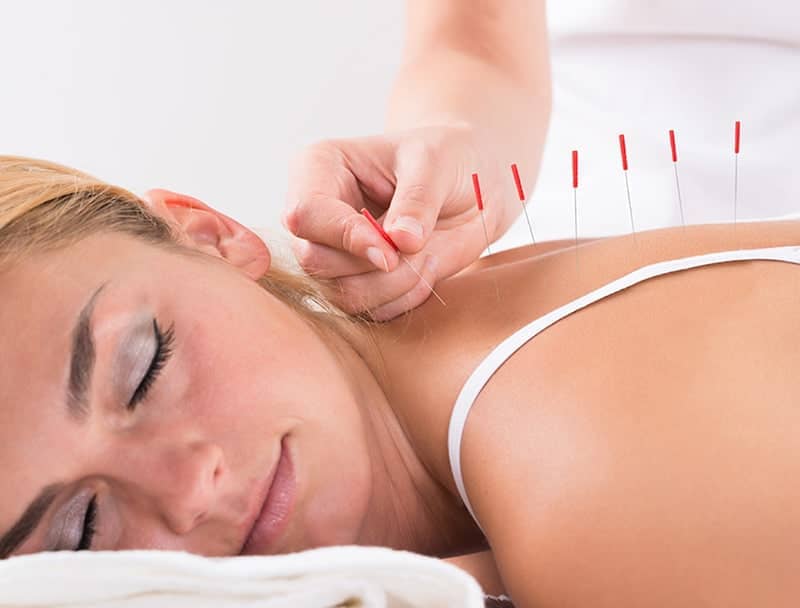Acupuncture Clinic in Calgary