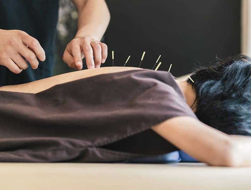 Calgary Acupuncture Clinic